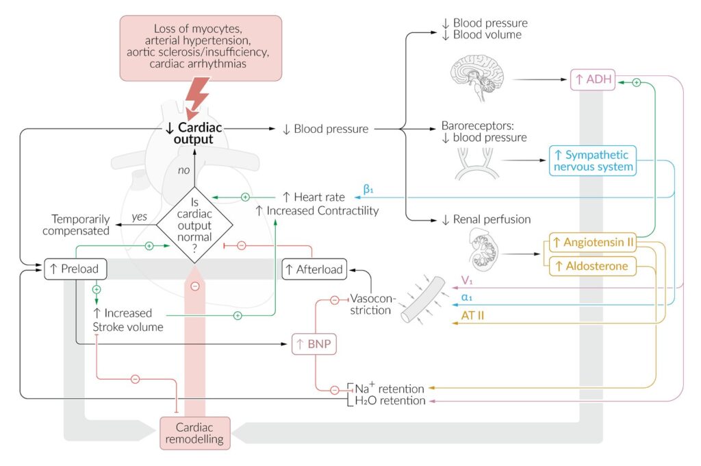 La reducción del gasto cardíaco produce la activación de mecanismos compensatorios (es decir, producción de ADH y BNP, activación del sistema renina-angiotensina y del sistema nervioso simpático) en un intento de restablecer el gasto cardíaco.
