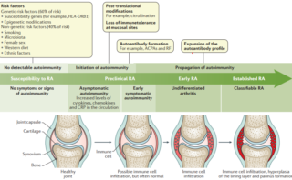 Insuficiencia suprarrenal primaria (Enfermedad de Addison)