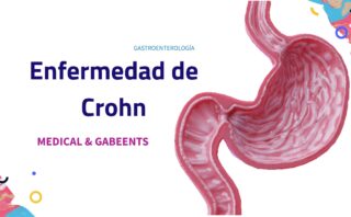 Síndrome de intestino irritable