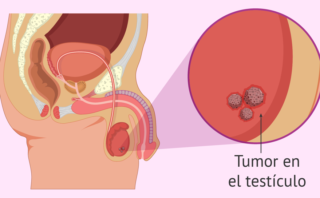 Transfusión restrictiva