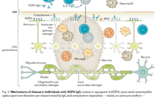 Rituximab: Indicaciones, Protocolo de Infusión y Complicaciones