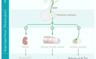 Anemia por inflamación