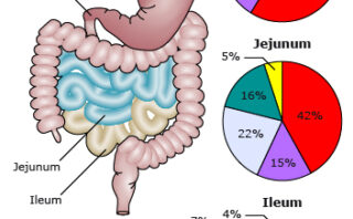 hipertensión arterial sistémica