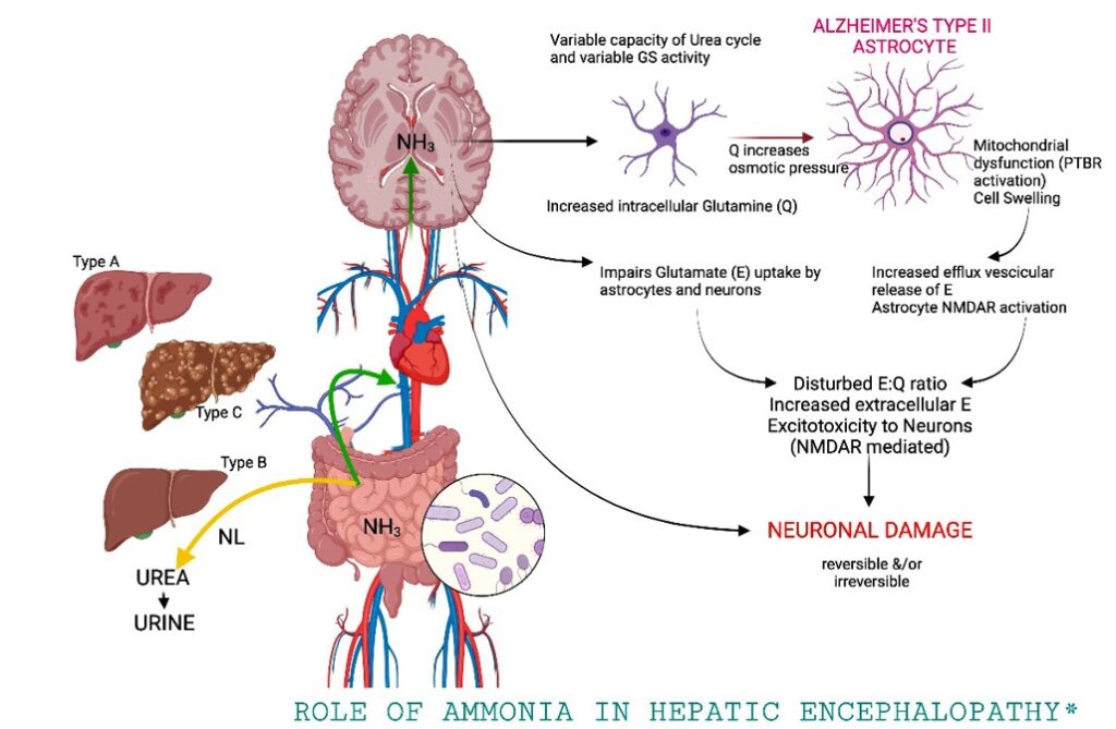 Rol del amoniaco en la fisiopatologia de la encefalopatía hepática