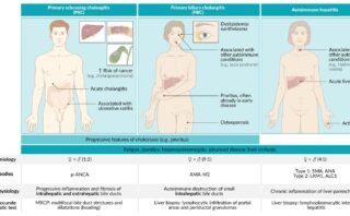 Apnea obstructiva del sueño