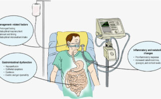 Úlceras por estrés en pacientes críticamente enfermos