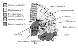 Hiperplasia prostática benigna