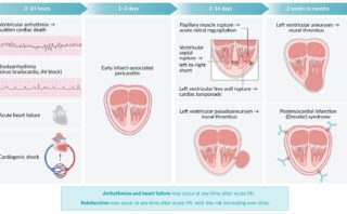 MONAH | Terapia médica de rutina en pacientes con SCA