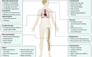 Colangitis esclerosante primaria