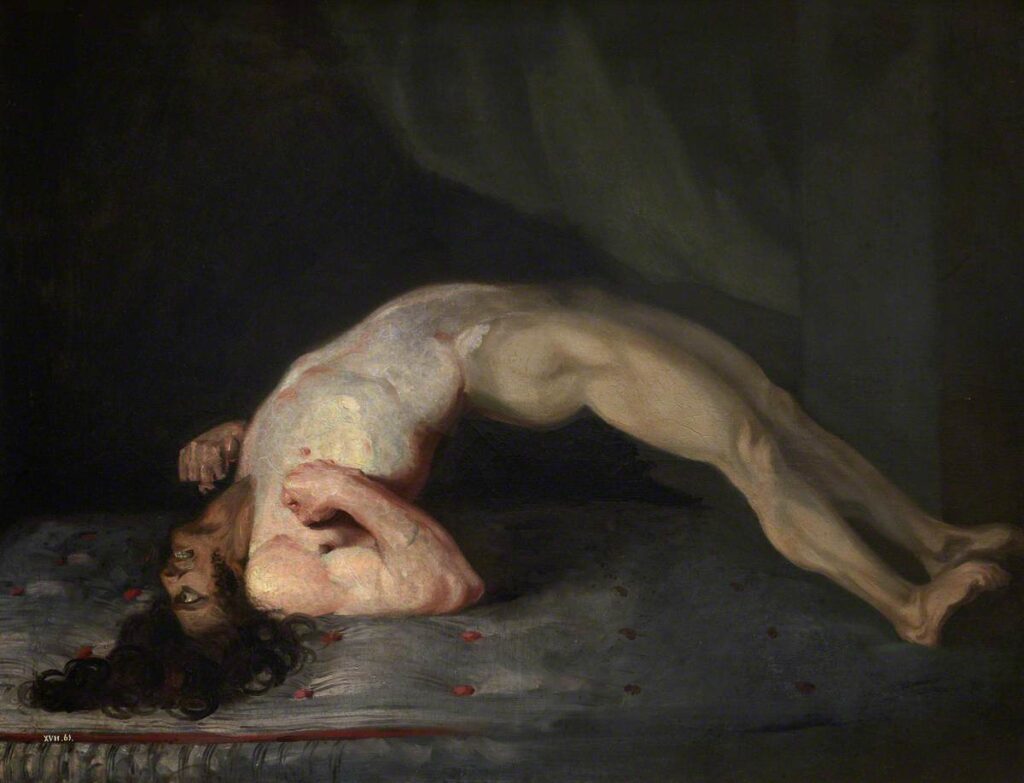 Opistótonos o espasmos musculares de un hombre que sufre de tétanos (1809).