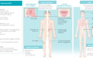 Virus de inmunodeficiencia humana