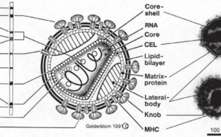 Infección aguda por VIH