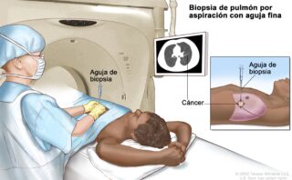 ARTRITIS REUMATOIDE