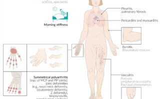 ¿QUÉ ES UNA BIOPSIA?