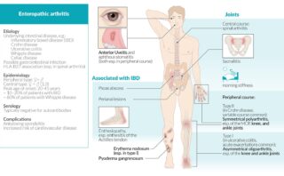 ARTRITIS PSORIÁSICA