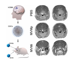 Modelo de terapia contra glioblastoma humano en ratón empleando el Parvovirus MVM.