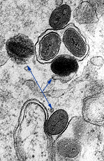 La micrografía electrónica muestra viriones vaccinia intracelulares en forma de ladrillo con núcleo central denso y membranas virales externas (flechas azules). La imagen de microscopía electrónica del virus de la viruela sería idéntica a la que se ve aquí con el virus vaccinia.