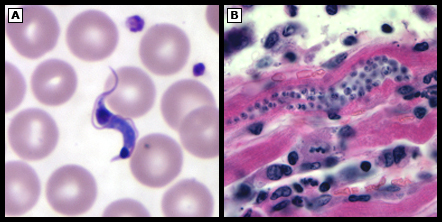 Trypanosoma cruzi: formas de tripomastigote y amastigote