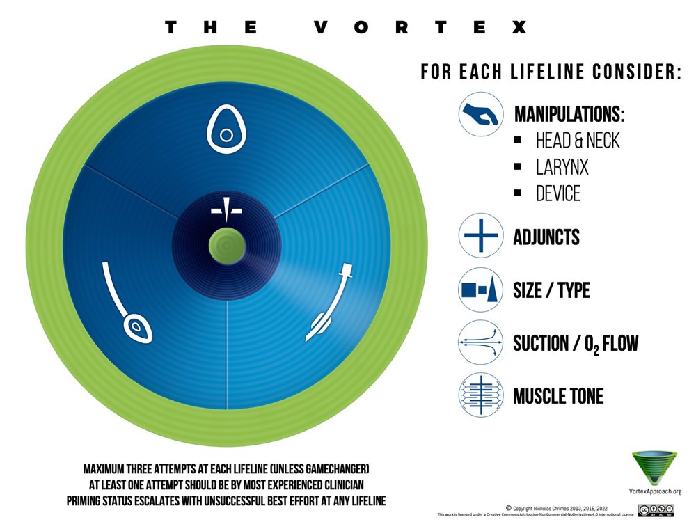 El Modelo del Vórtex