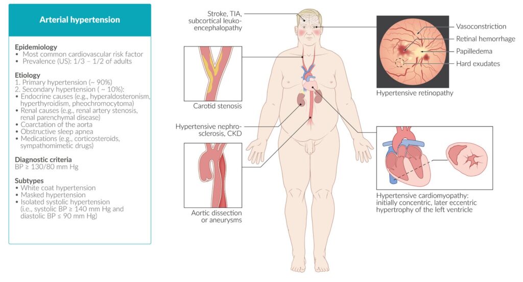 hipertension arterial