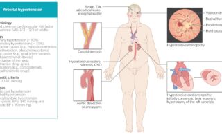 Gasometría Arterial