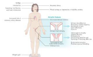 Fístula Recto-Vaginal