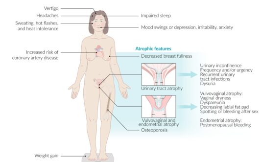 Regulación Neuroendocrina de la Obesidad