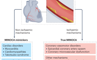 Síndrome de Takotsubo: Diagnóstico y Manejo Clínico