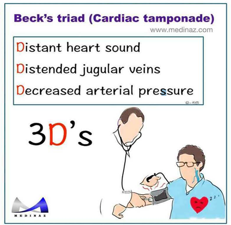 La imagen muestra un esquema educativo sobre la "Tríada de Beck" en el contexto de un tamponamiento cardíaco. 