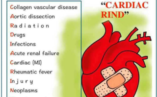 Fatty SOFT HAM | Enfermedad arterial coronaria