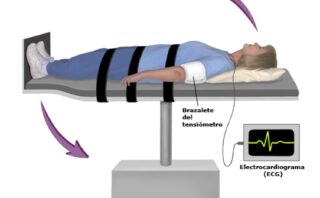 Tuberculosis latente – CASO CLÍNICO