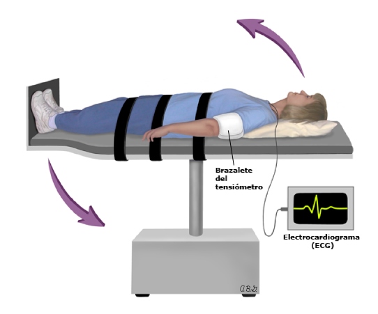 Prueba de inclinación ortostática (Tilt Test) para evaluar el síncope, mostrando a un paciente asegurado a la mesa inclinable con monitoreo de presión arterial y ECG