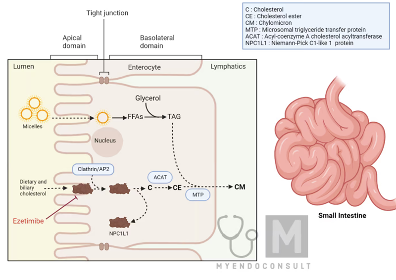 Mecanismo de acción de la ezetimiba. La ezetimiba inhibe la absorción de colesterol en el intestino delgado al bloquear la proteína transportadora NPC1L1 en la membrana apical de los enterocitos. Esto impide la internalización del colesterol dietético y biliar, reduciendo su transporte a través del enterocito y su incorporación a los quilomicrones (CM). Como resultado, se disminuye el aporte de colesterol al hígado, lo que provoca un aumento en la expresión de receptores de LDL y una reducción de los niveles de colesterol LDL en sangre.