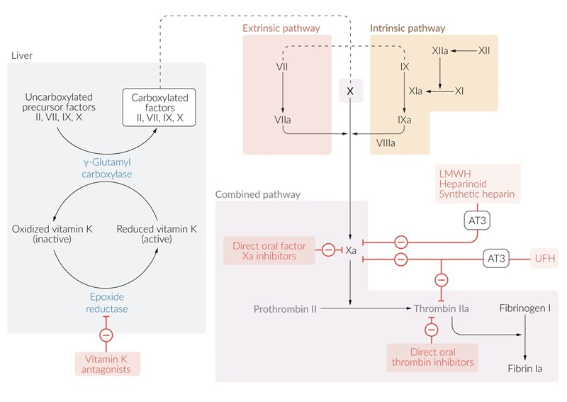 Diagrama del mecanismo de acción de los anticoagulantes orales, incluyendo antagonistas de la vitamina K, inhibidores directos del factor Xa y trombina, así como la interacción con la cascada de coagulación. Se muestra el proceso de activación de los factores de coagulación dependientes de vitamina K en el hígado, la vía intrínseca y extrínseca de la coagulación, y la inhibición de los factores clave en la generación de trombina. También se destacan los efectos de la heparina y sus derivados sobre la antitrombina III (AT3) y la inhibición de la formación de fibrina.