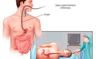 CASO CLÍNICO | Colecistectomía – Valoración preoperatoria.