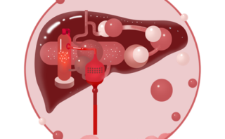 Hipertensión Arterial: Causas, Síntomas y Tratamiento