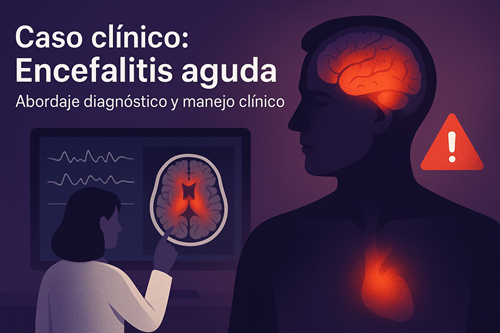 Ilustración médica que representa un caso clínico de encefalitis aguda. Se observa un paciente con inflamación cerebral resaltada en tonos rojos y anaranjados, junto a una médica analizando una resonancia magnética y trazados de EEG, simbolizando el diagnóstico y manejo clínico de esta urgencia neurológica