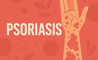 Desmielinización Osmótica Tras Diálisis en Hiponatremia Severa: Un Caso Clínico